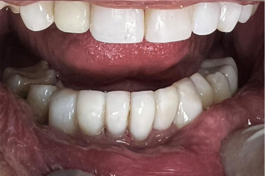 facetas 2
